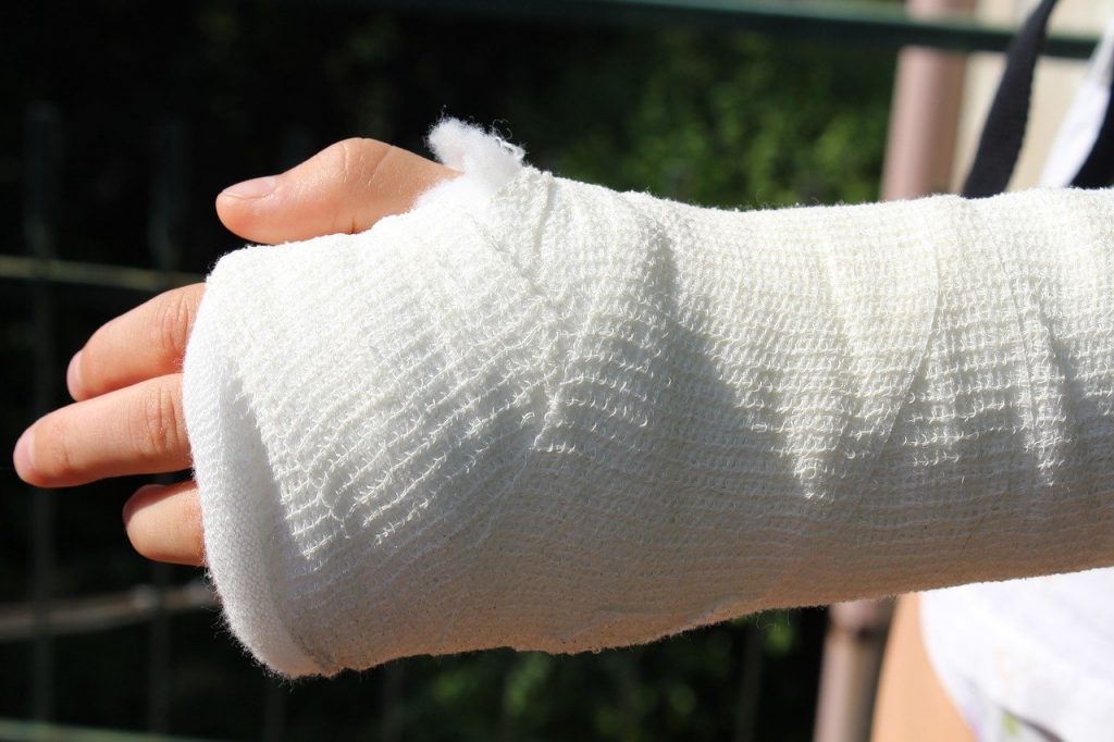 Gips_Jagdfakten.at_pixabay